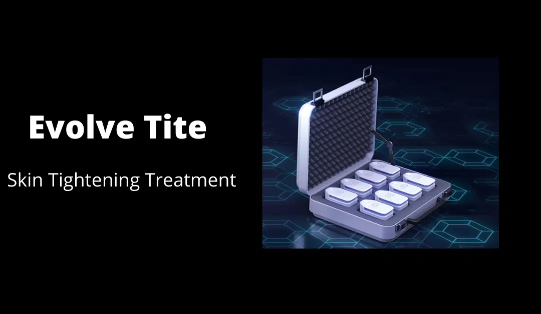 The Latest Skin Tightening Treatment To Hit The Market!