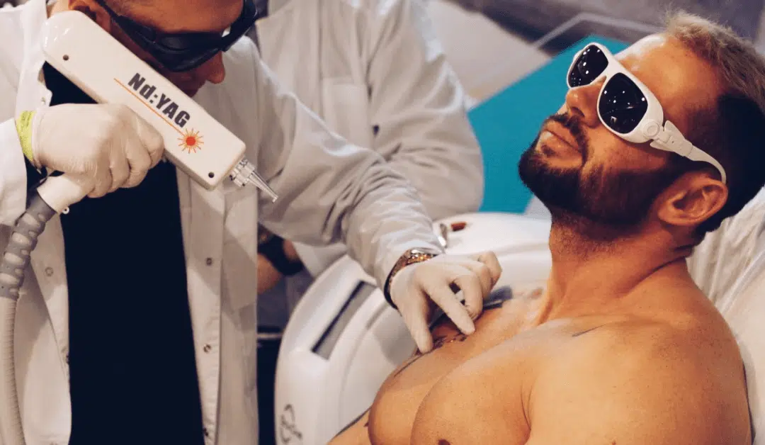 Does Tattoo Removal Work?