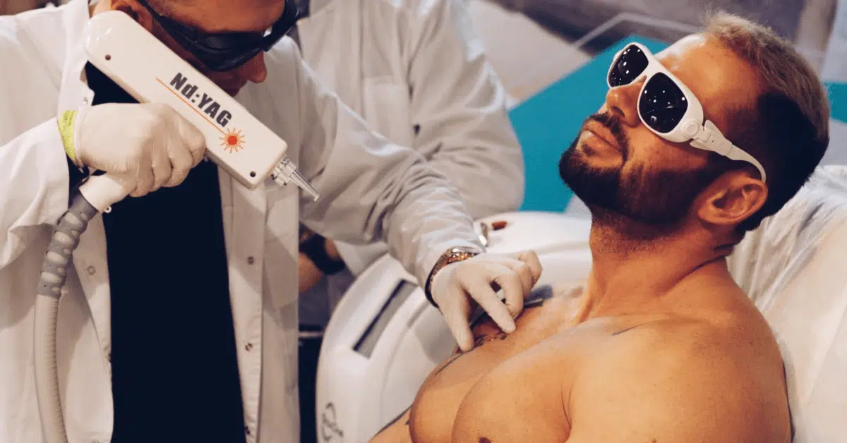 tattoo-removal-in-orlando