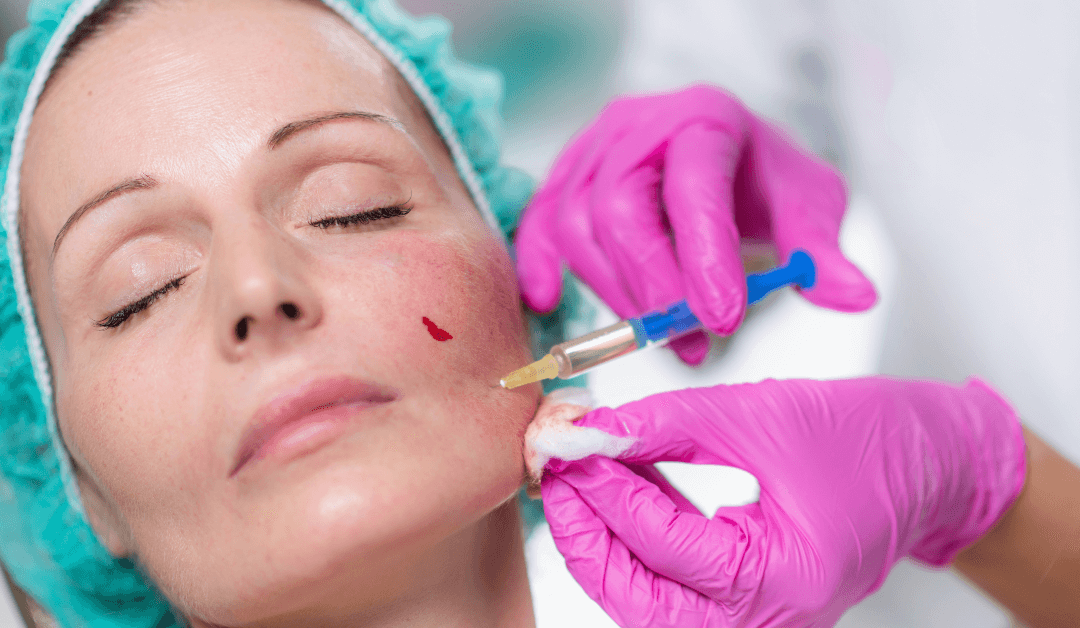 Face Fillers – Here’s What You Should Know