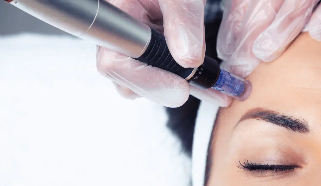 The Latest Skincare Treatment You Should Try!