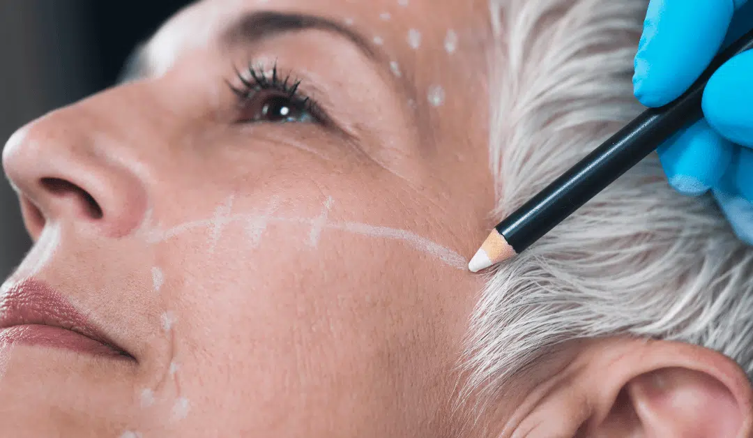 Non Surgical Face Slimming Becoming More & More Popular