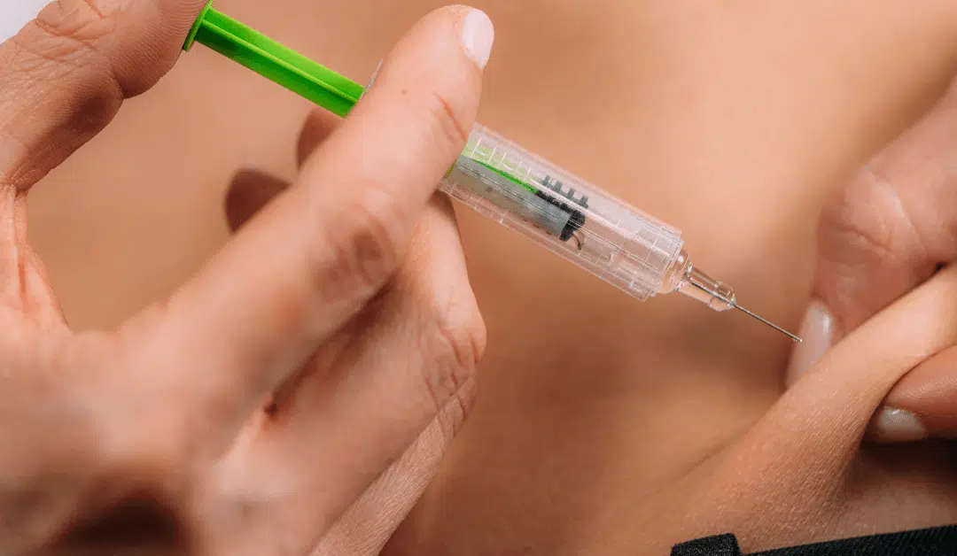 5 Things to Know about Dysport