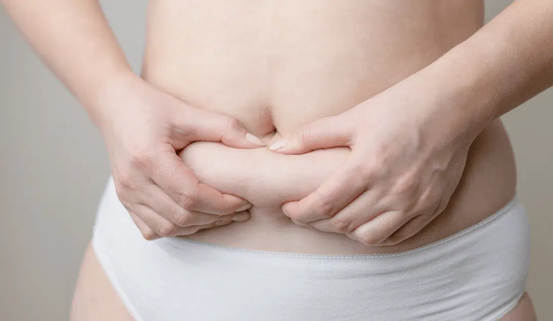 Why More Orlando Residents Are Choosing Coolsculpting