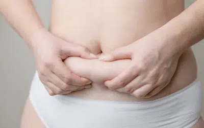 Why More Orlando Residents Are Choosing Coolsculpting