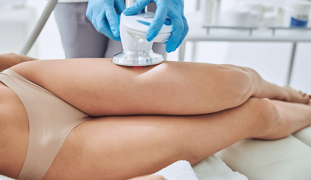 Coolsculpting Vs. Fat Freezing: Which Is Best For You?
