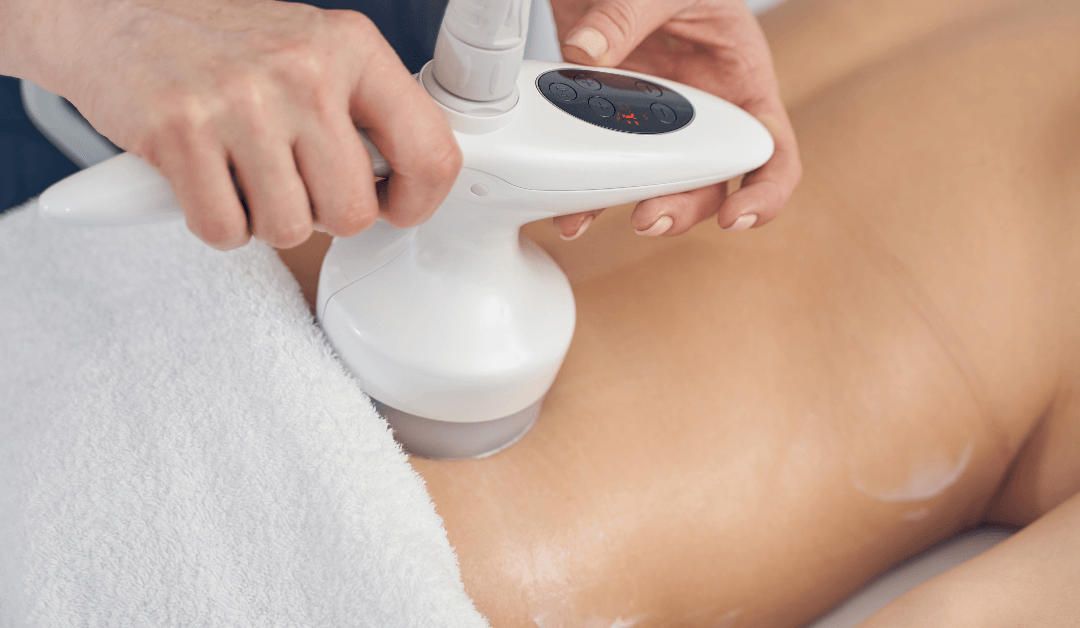 The Process And Benefits Of Coolsculpting In Orlando