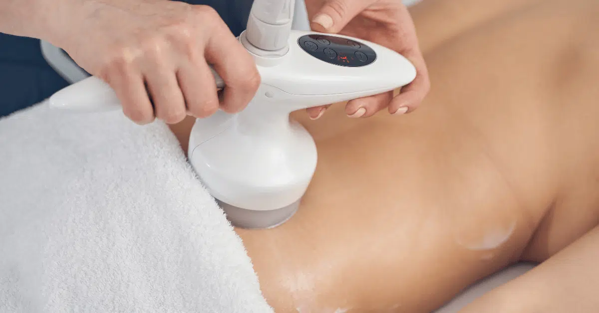 CoolSculpting in Orlando CoolSculpting in Orlando