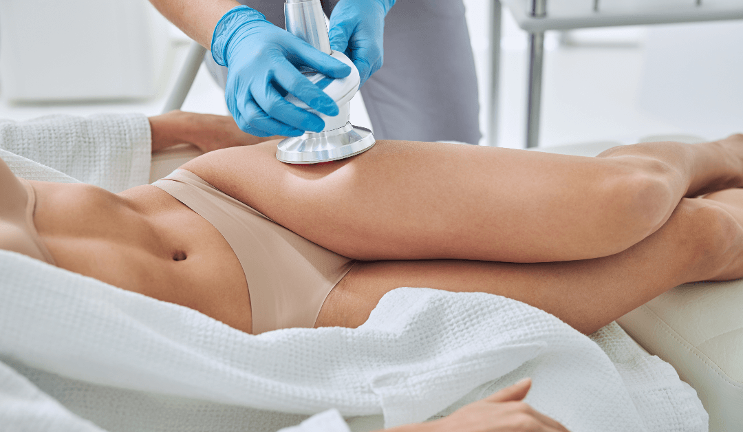 What Is Coolsculpting And Does It Work?