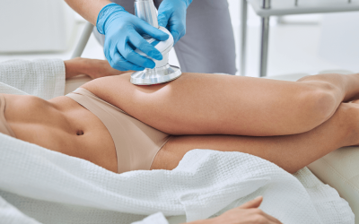What Is Coolsculpting And Does It Work?