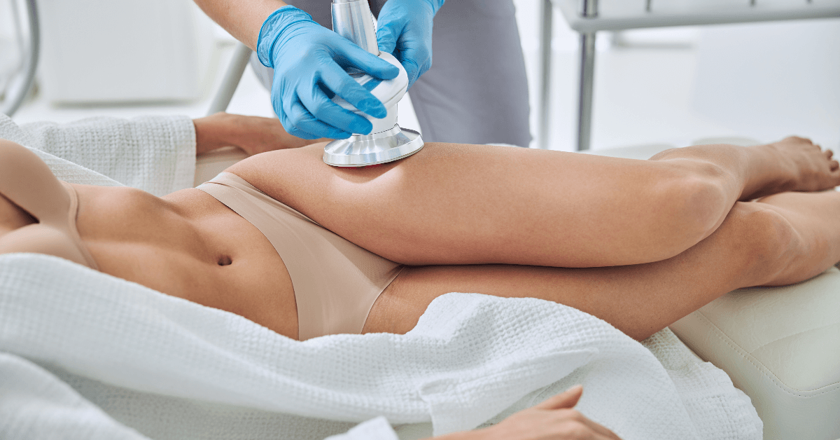 What Is Coolsculpting