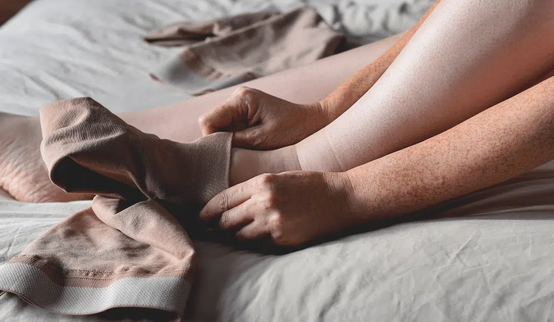 Compression Garments and CoolSculpting!