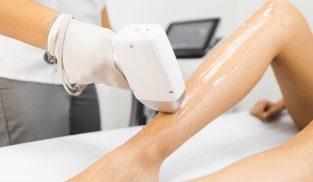 The Ultimate Guide to Laser Hair Removal at Wymore Laser and AntiAging Medicine in Winter Park, Florida