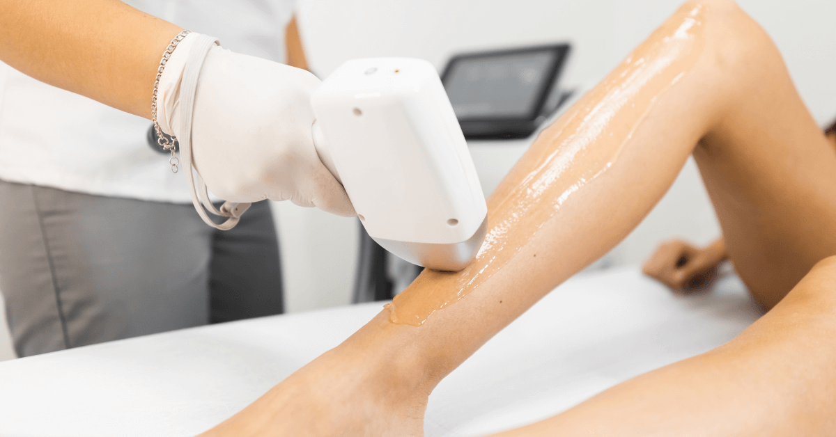 Laser Hair Removal