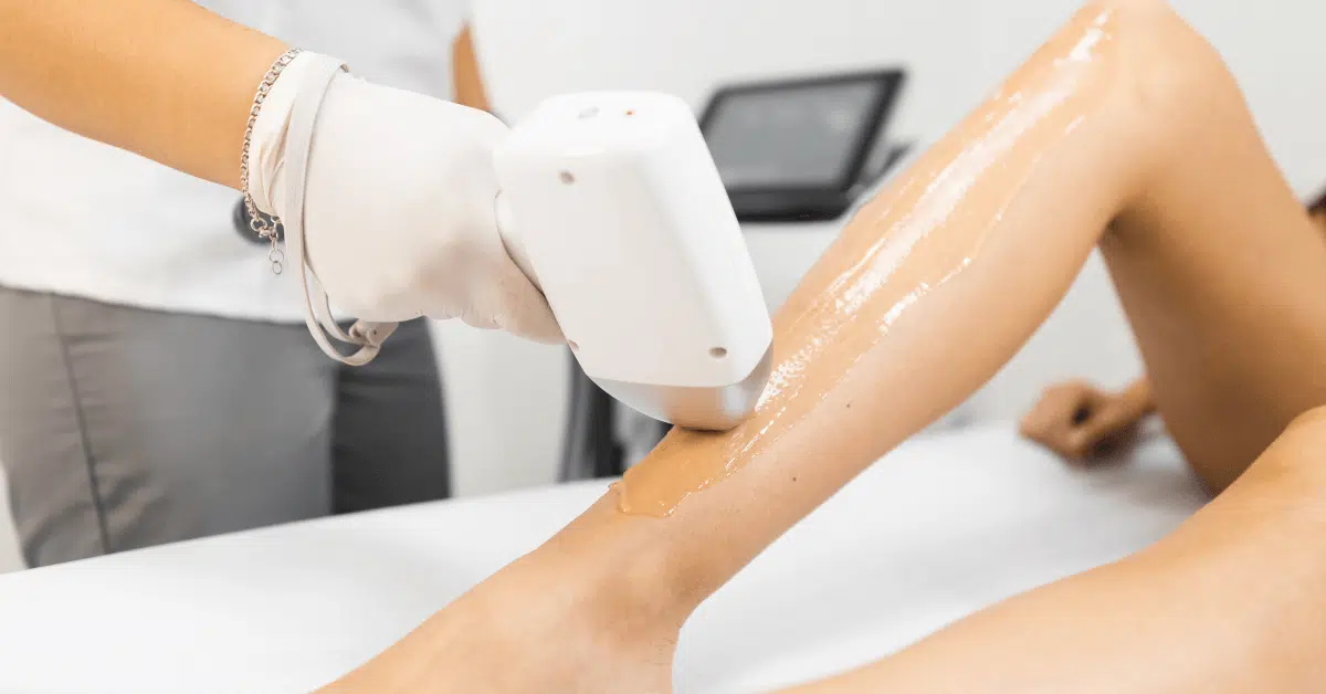 Laser Hair Removal