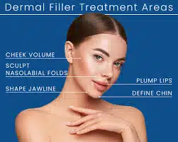 Kissed by Confidence: Transform Your Lips with Expert Lip Filler Procedures