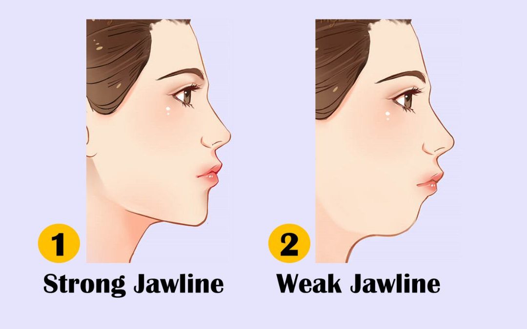 Non Surgical Jawline Contouring with Wymore Laser & Anti-Aging