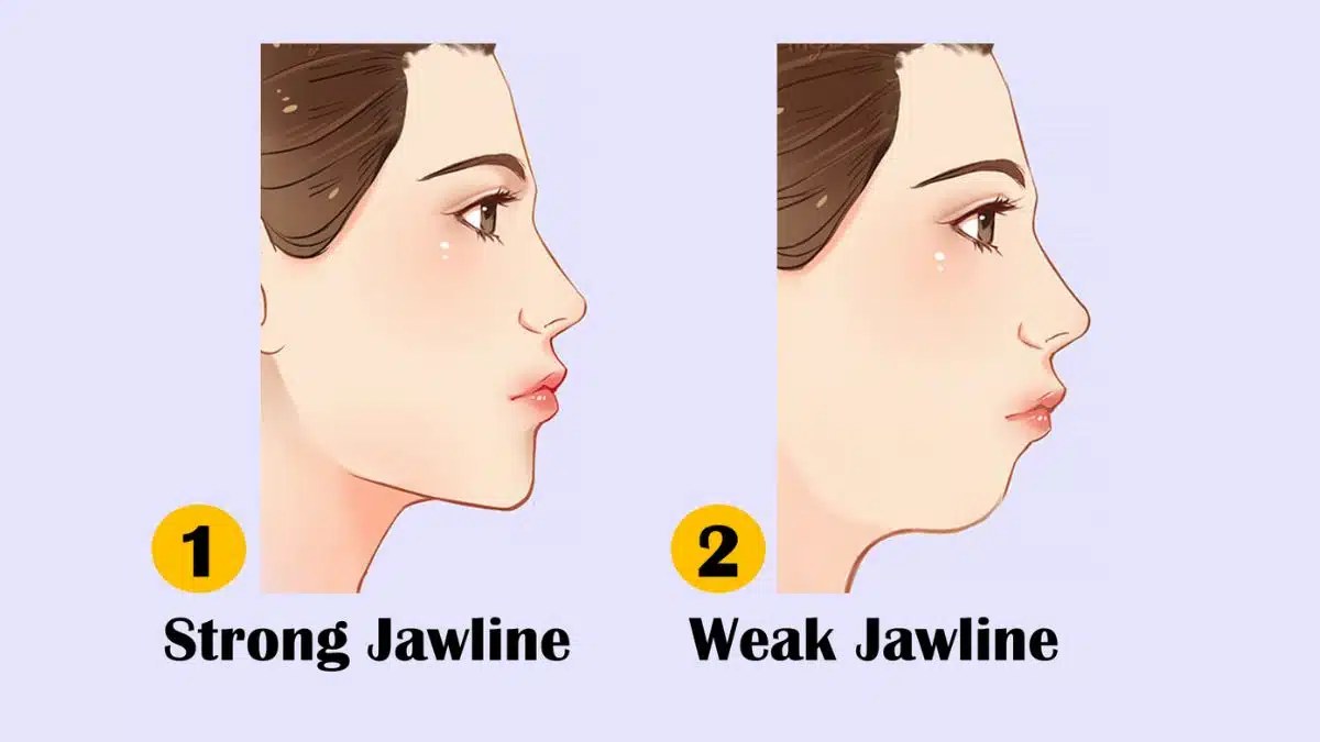 Jawline Types