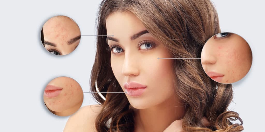 Laser Scar Removal in Town
