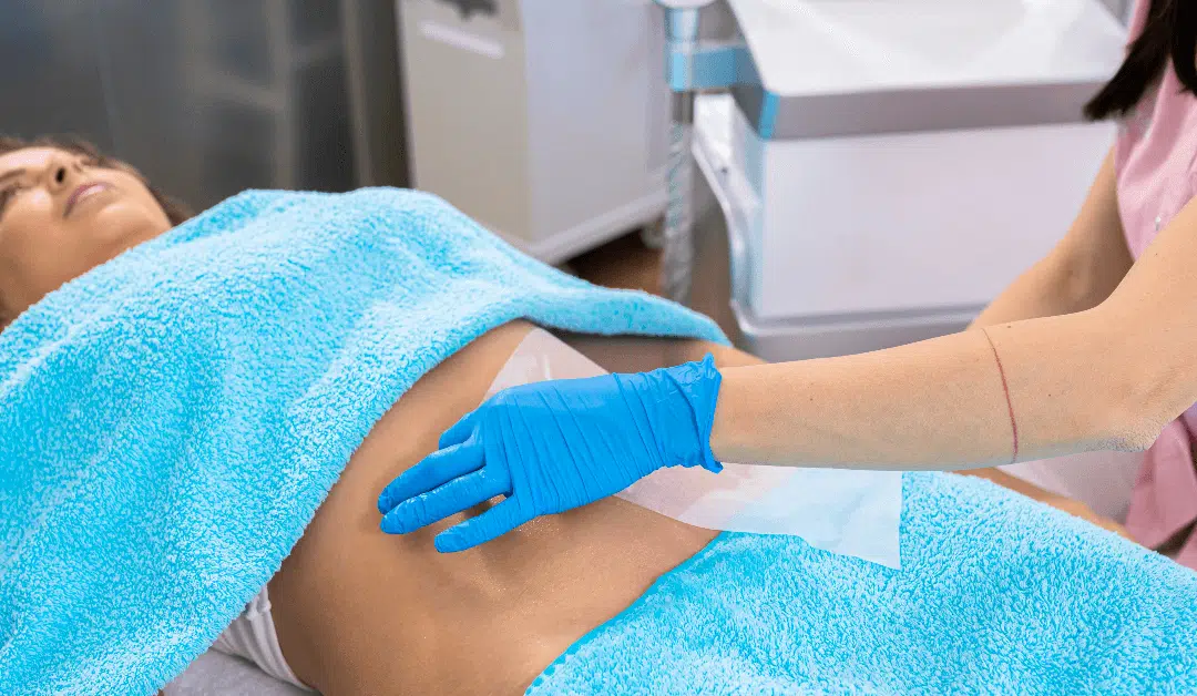CoolSculpting in Orlando: Transform Your Body with Precision