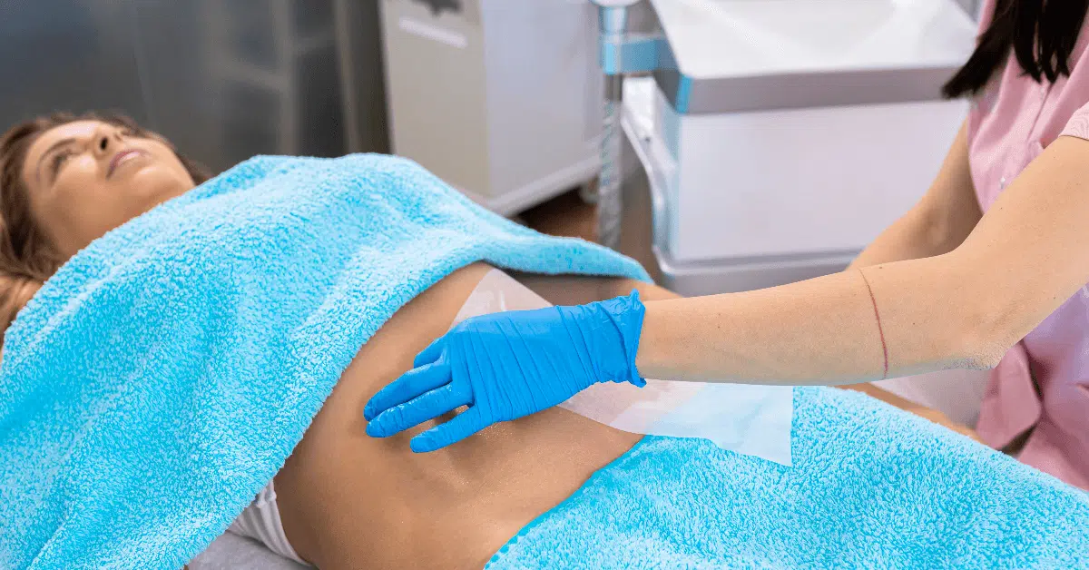 CoolSculpting in Orlando