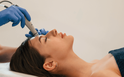 Elevate Your Skincare Routine: Exploring Microneedling