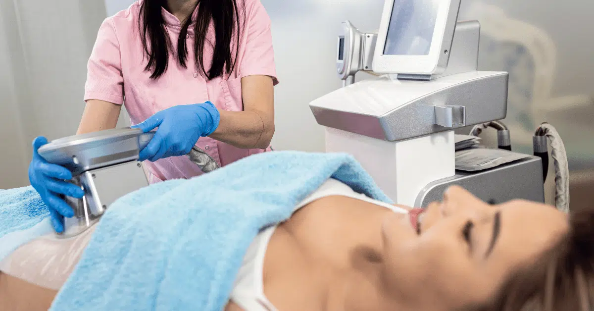 CoolSculpting result CoolSculpting result