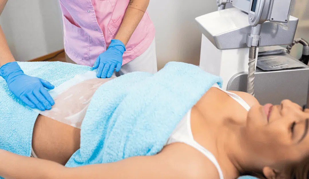 The Science Behind CoolSculpting: How Fat Freezing Works?