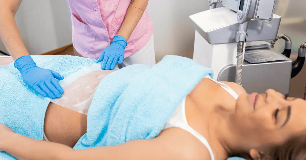 CoolSculpting Near Me