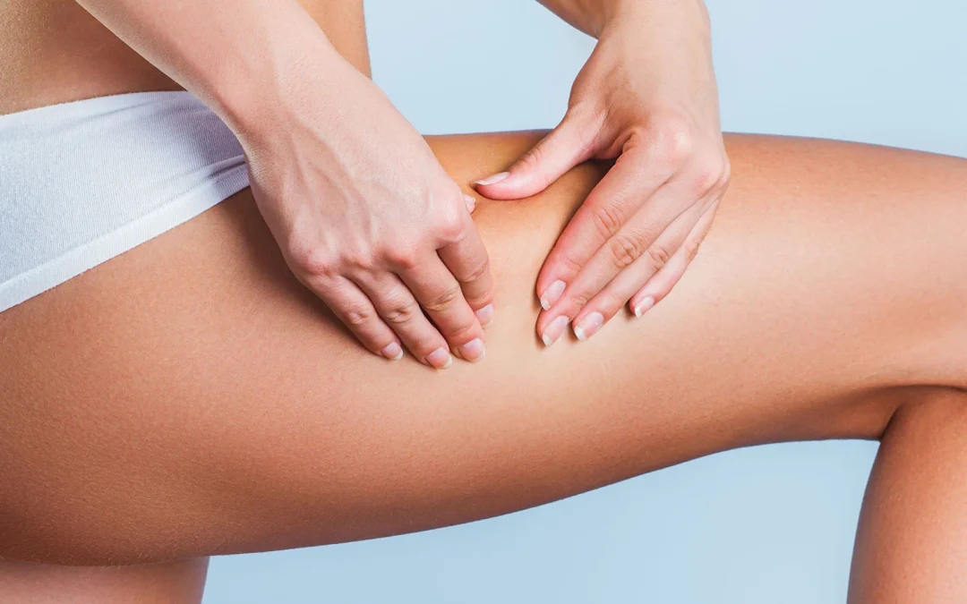 Achieving Radiant Skin: Laser Treatment for Cellulite and Acupuncture in Orlando