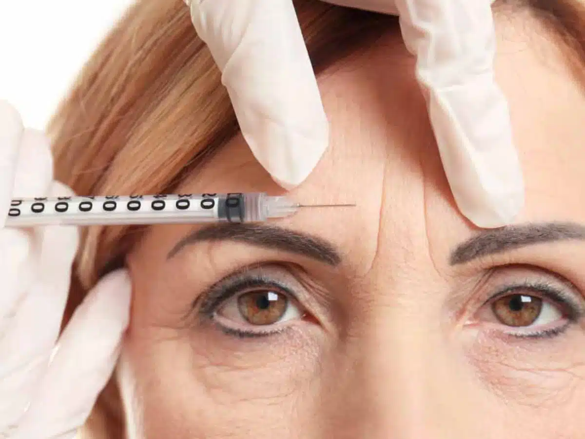 treatment-wrinkle