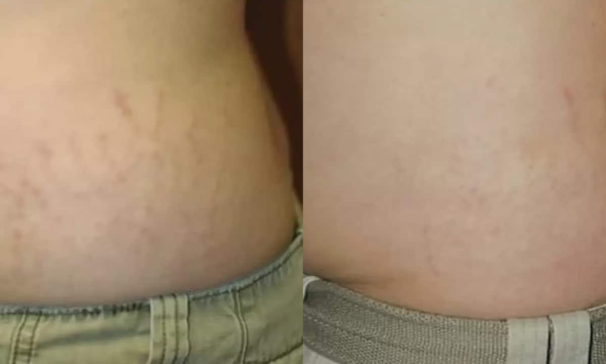 after-bb