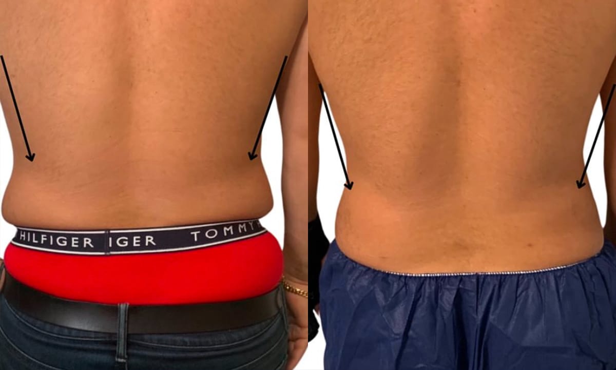 after-bb