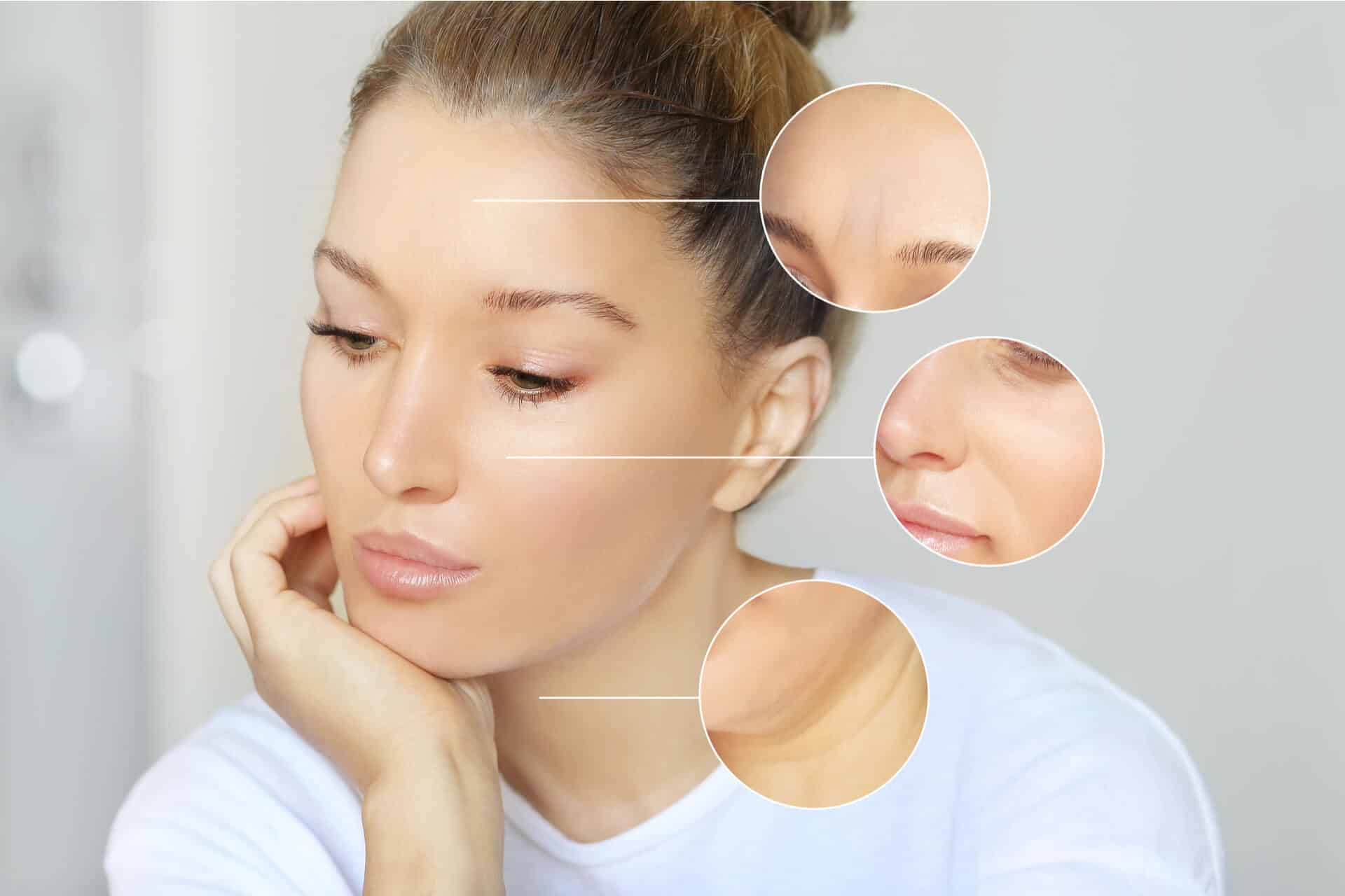 Botox Facial Injections