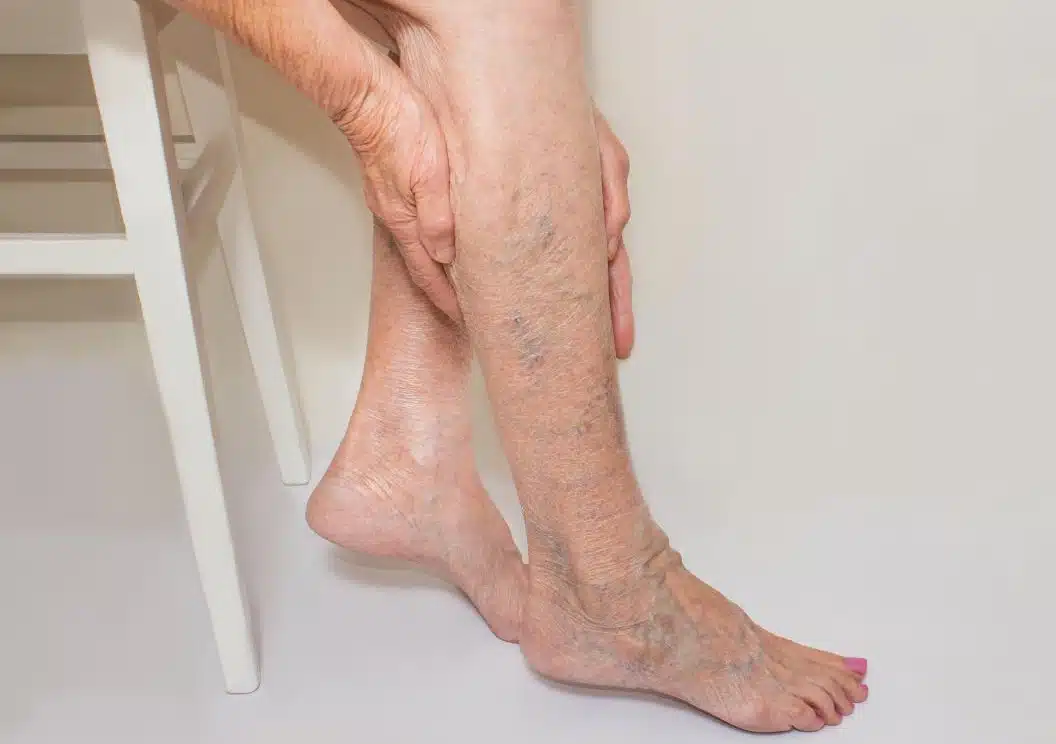 Restore, and Rejuvenate