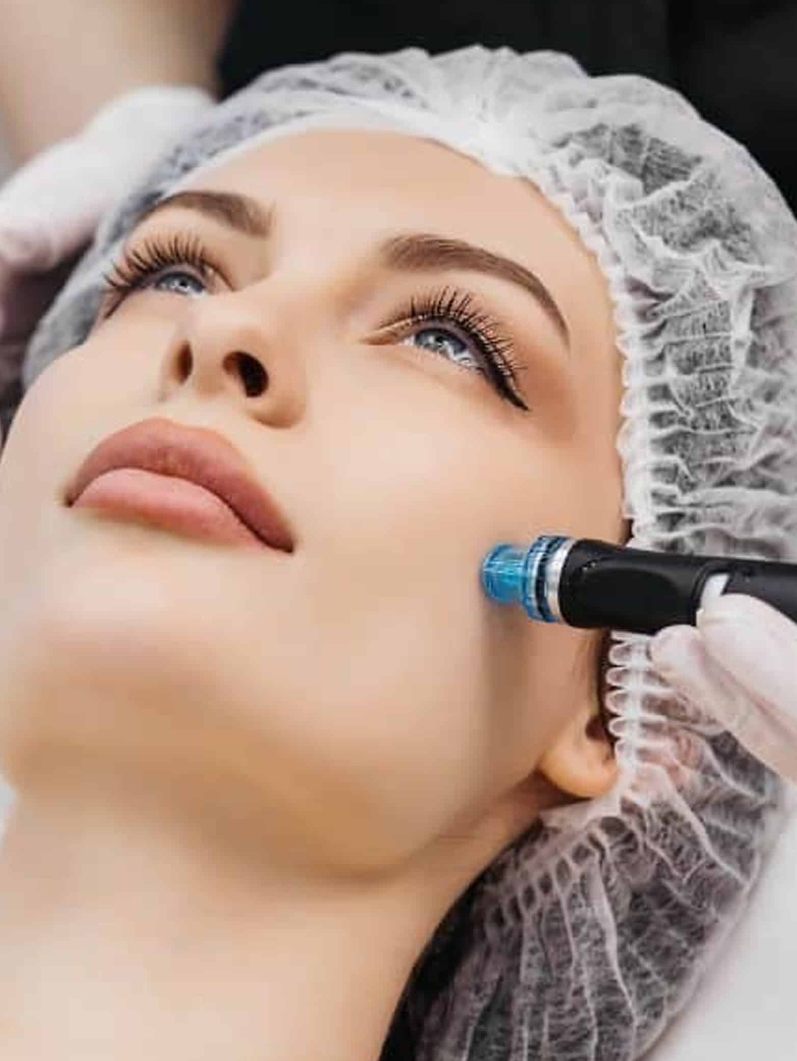Skin Tightening