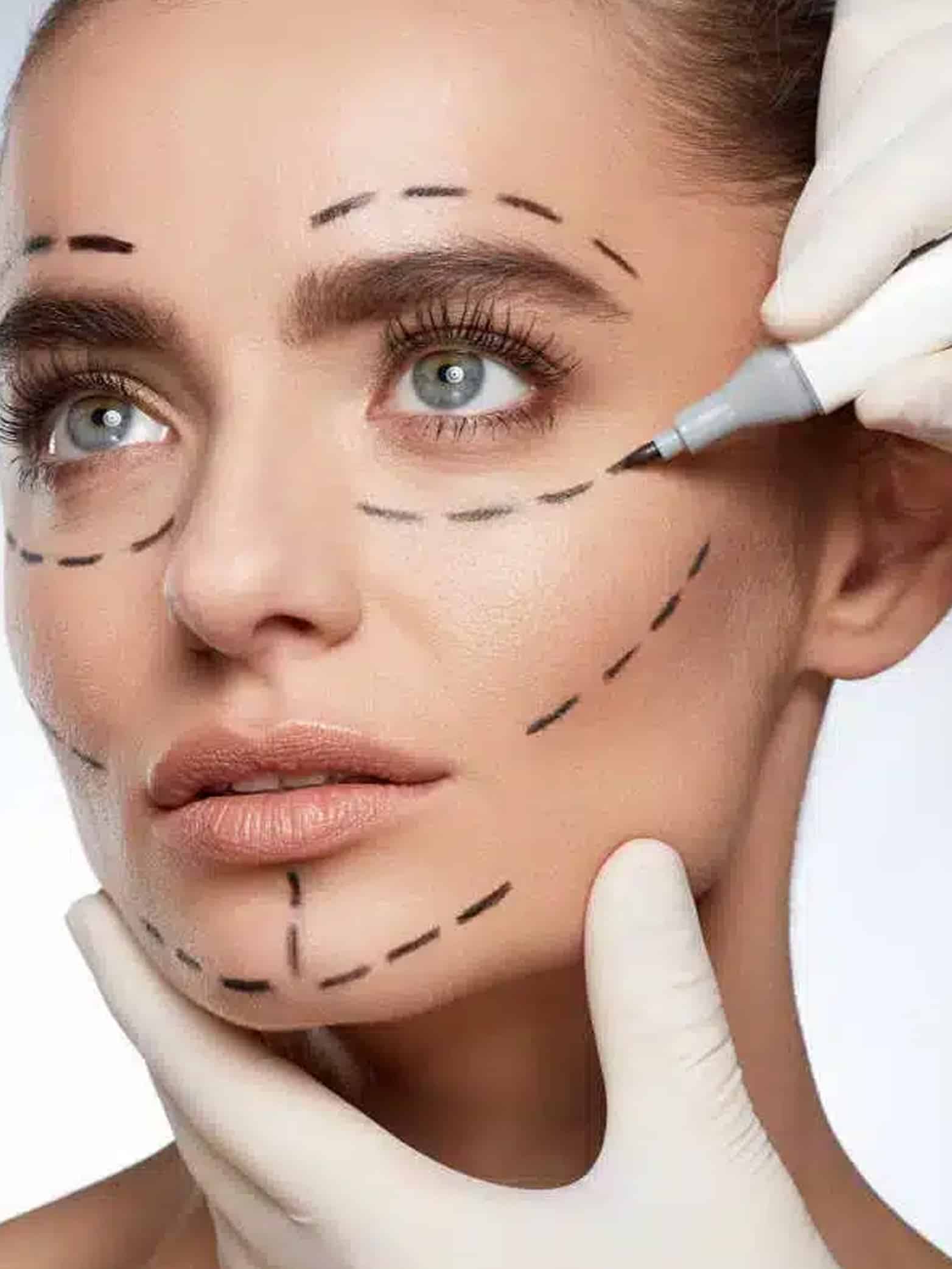 Facial Rejuvenation