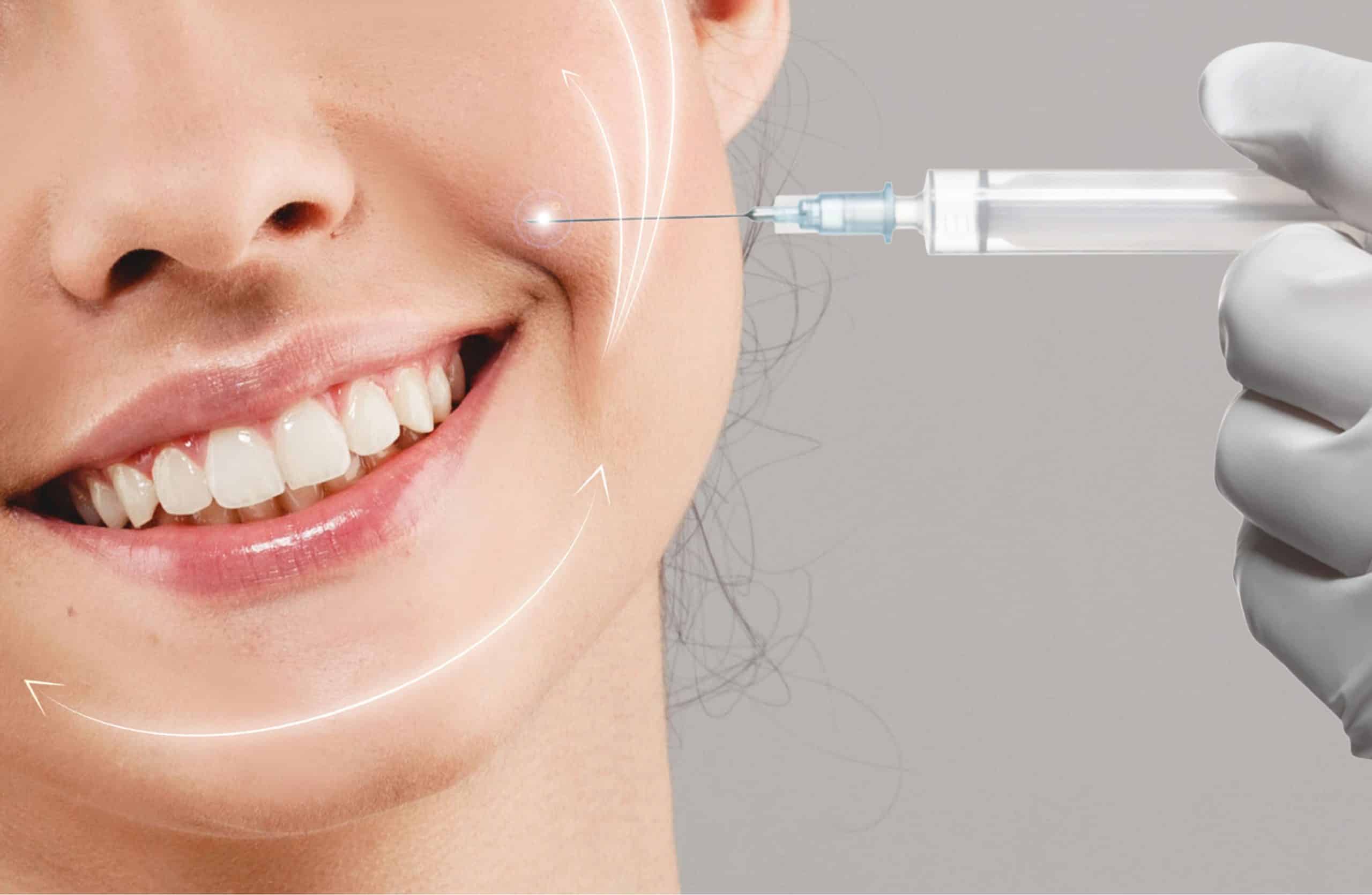 Galderma Fillers in Orlando