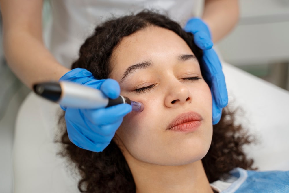 Micro Needling Orlando
