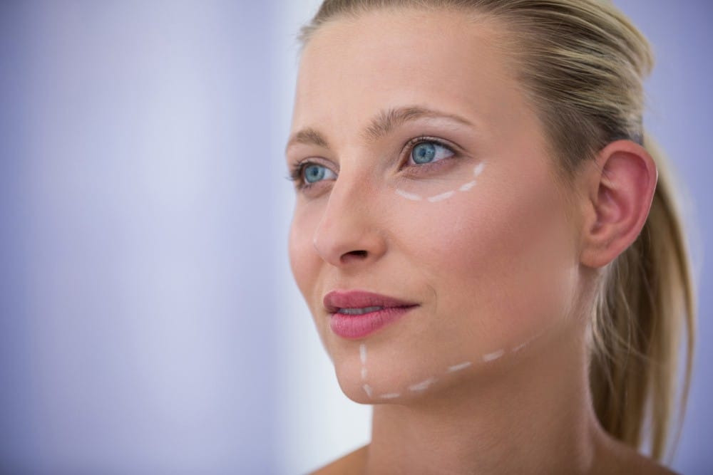 Thread Lift in Winter Park, FL – Non-Surgical Facelift