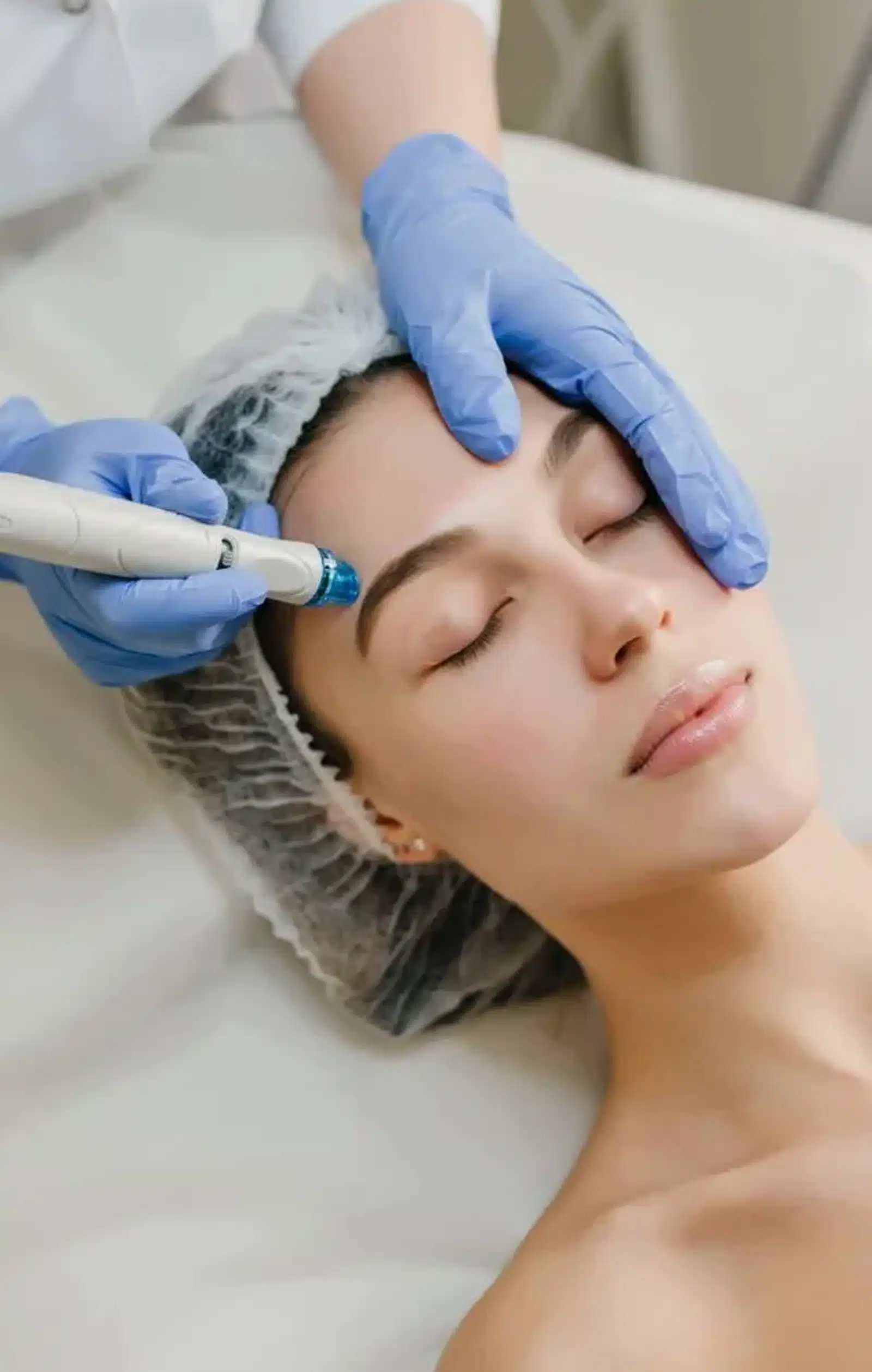 Benefits of PRP Microneedling Benefits of PRP Microneedling