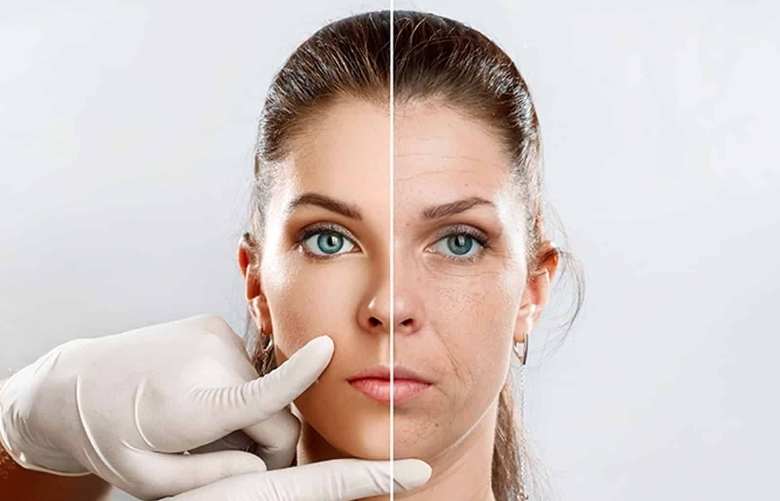 Botox Consultation Today Botox Consultation Today
