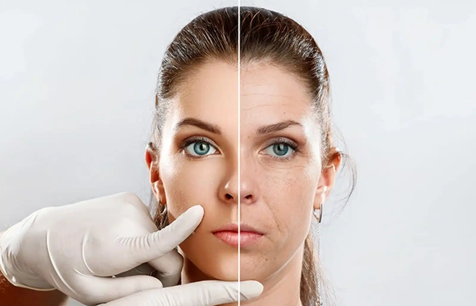 Botox Consultation Today Botox Consultation Today