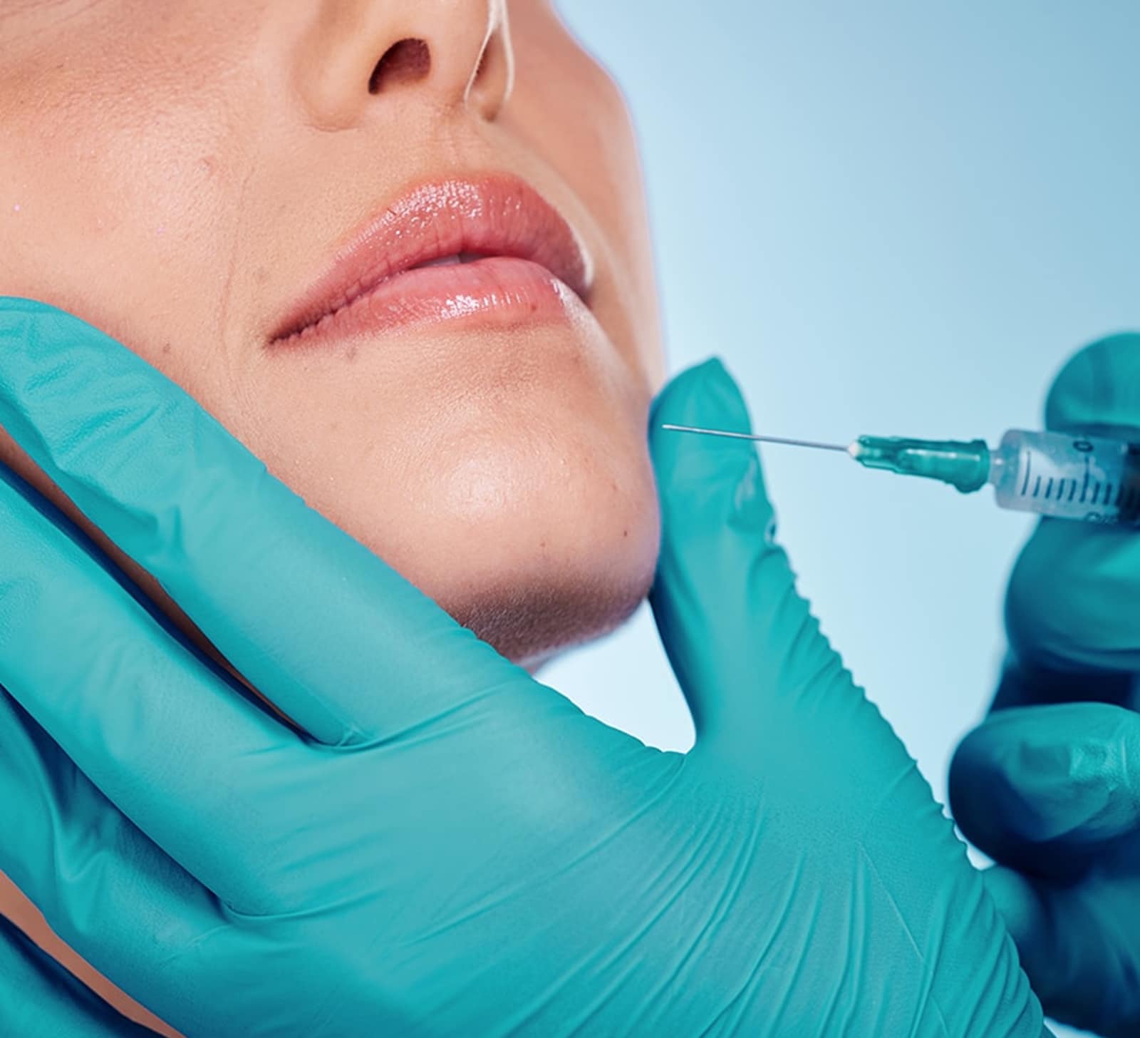 Botox with Dermal Fillers for Enhanced Results Botox with Dermal Fillers for Enhanced Results