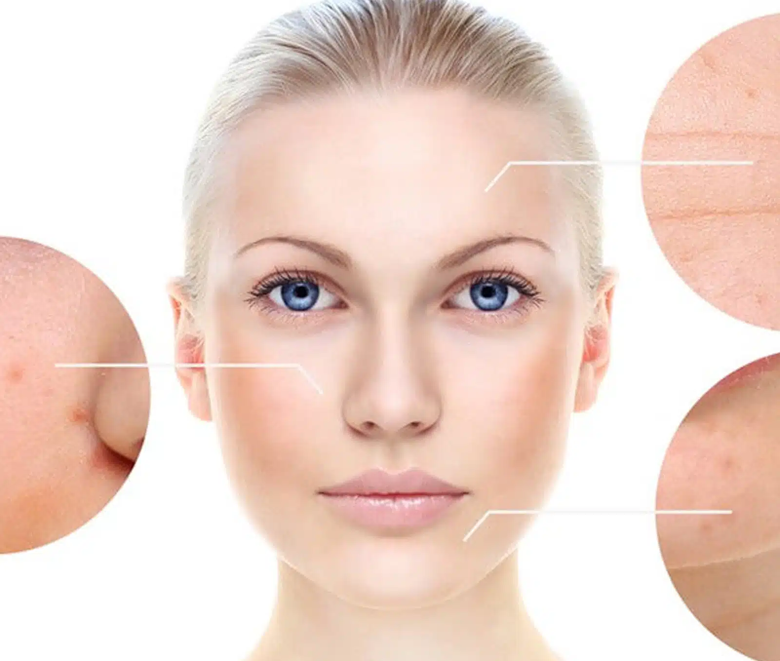 Brighter, smoother skin texture Brighter, smoother skin texture