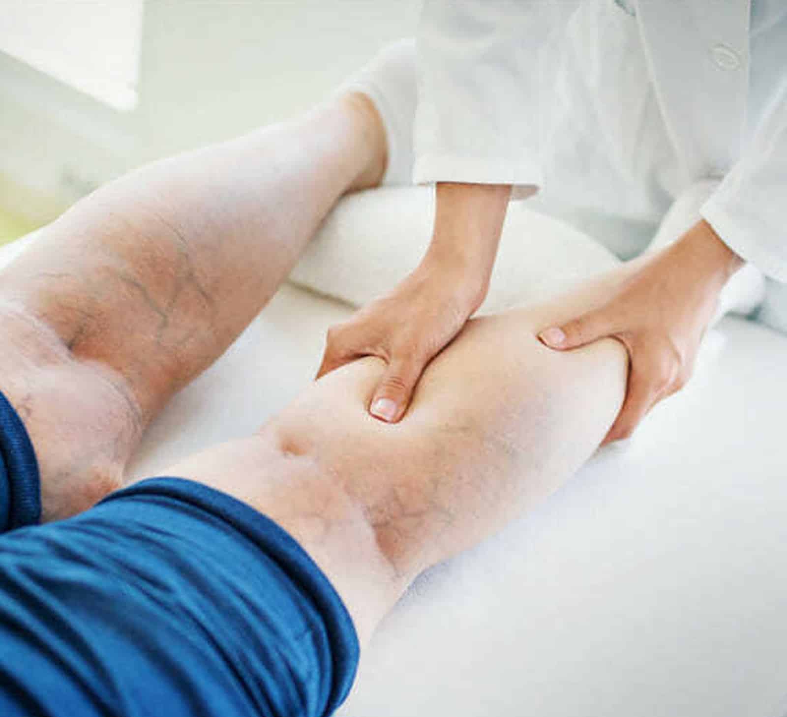 Cost of Spider Vein Removal in Orlando Cost of Spider Vein Removal in Orlando