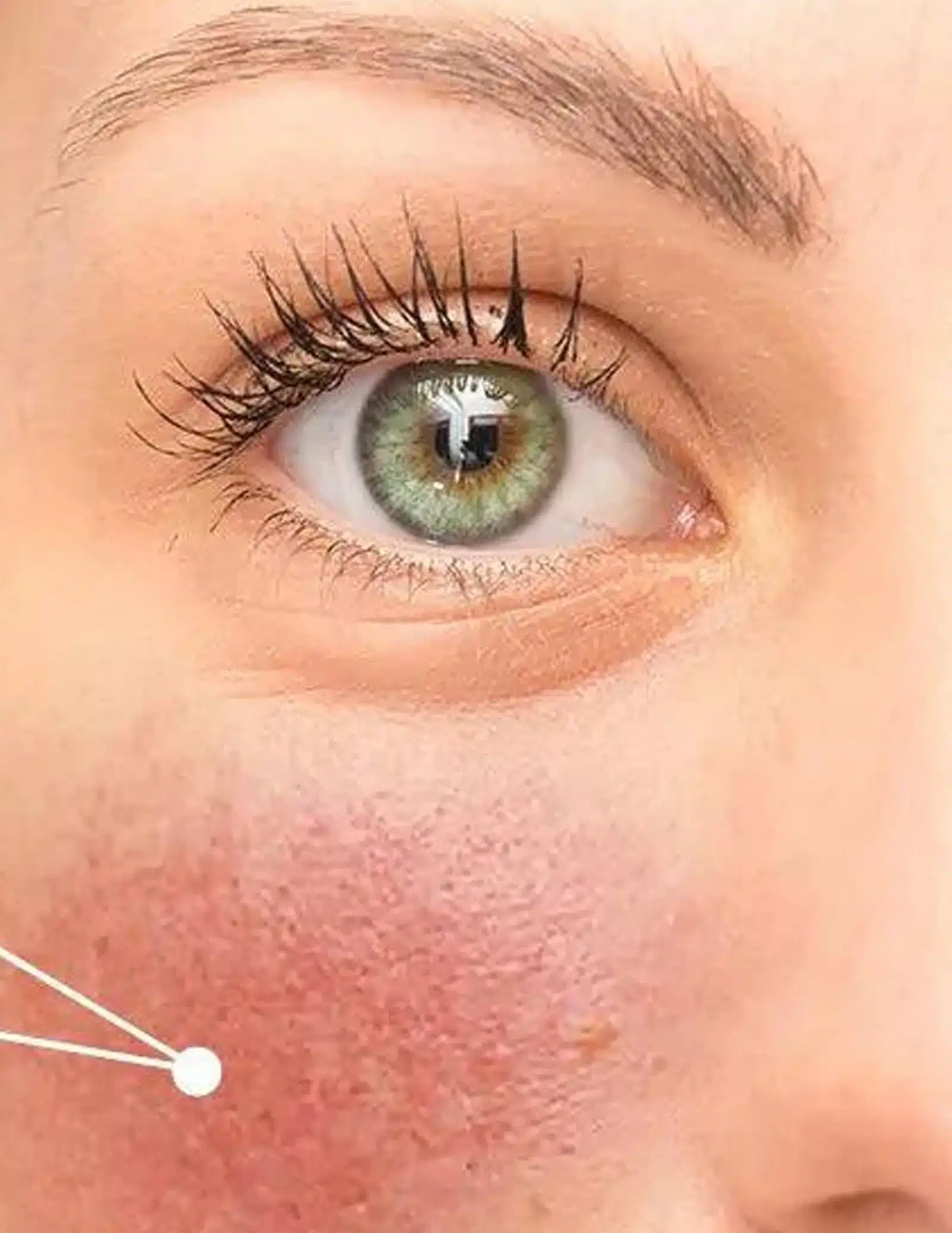 During-the-Treatment During the Treatment