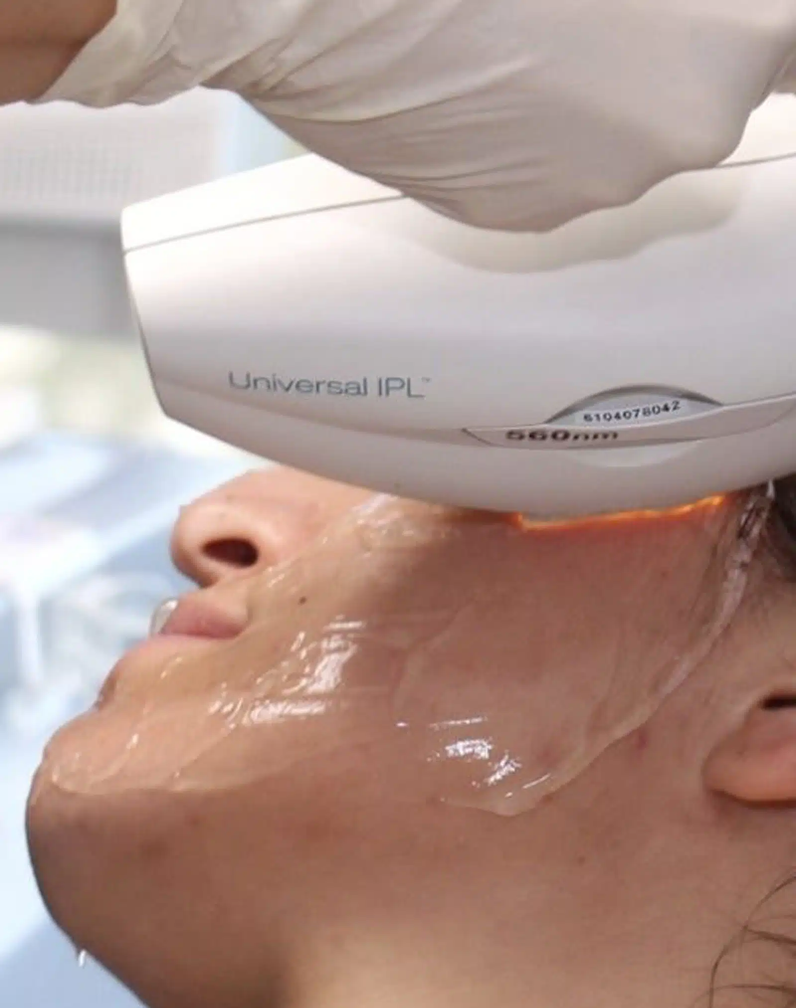 Eliminates Age Spots and Sun Eliminates Age Spots and Sun