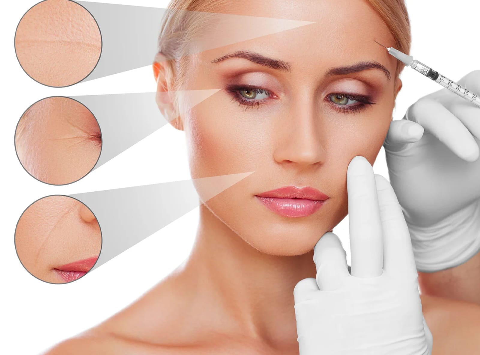 Expect After Botox Treatment Expect After Botox Treatment