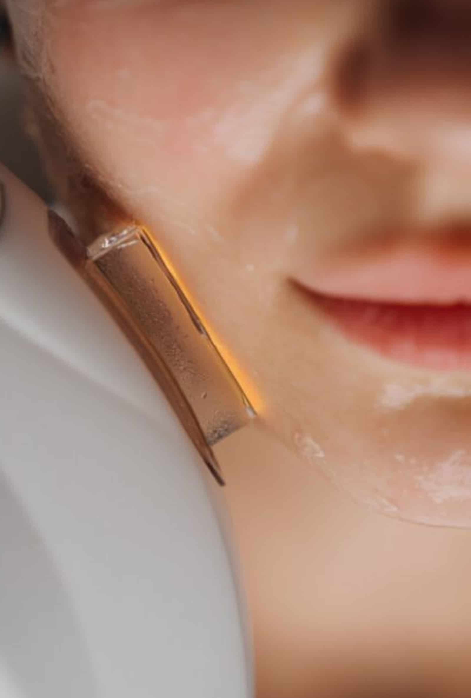 IPL Photofacial Procedure at Wymore Laser IPL Photofacial Procedure at Wymore Laser